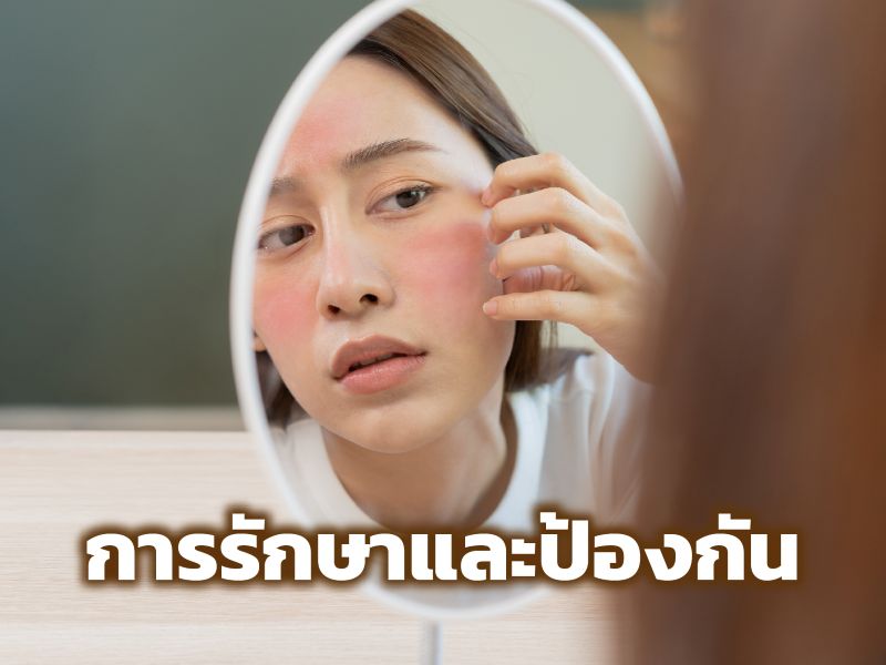 การรักษาและป้องกันก็แตกต่างกัน
