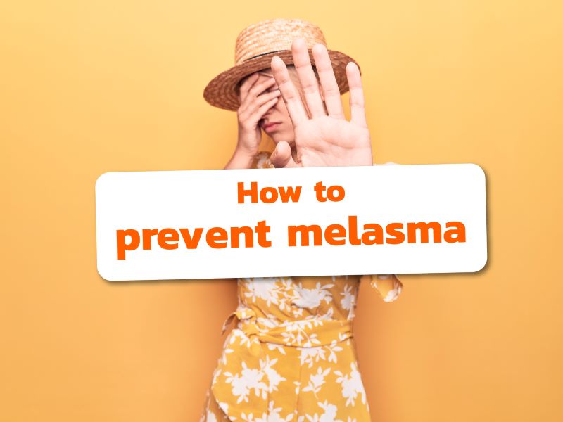 How to prevent melasma